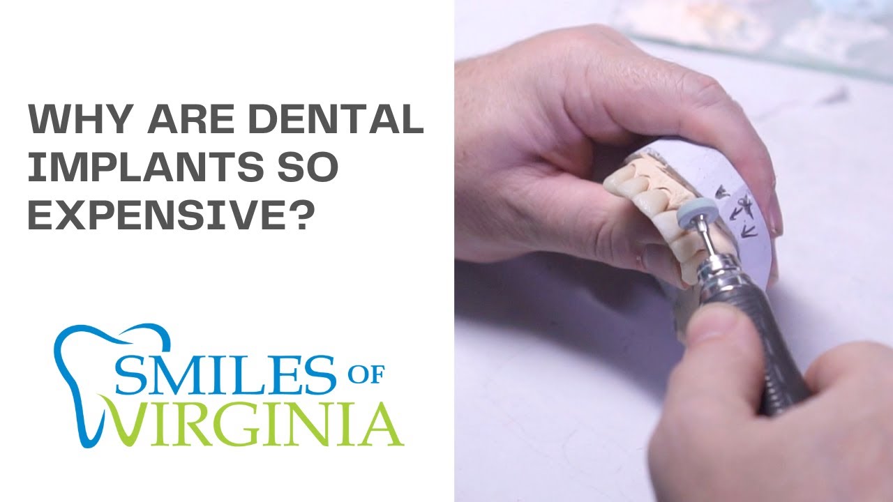 Where dental implant costs actually go — Dr. Oestervemb explains (video)