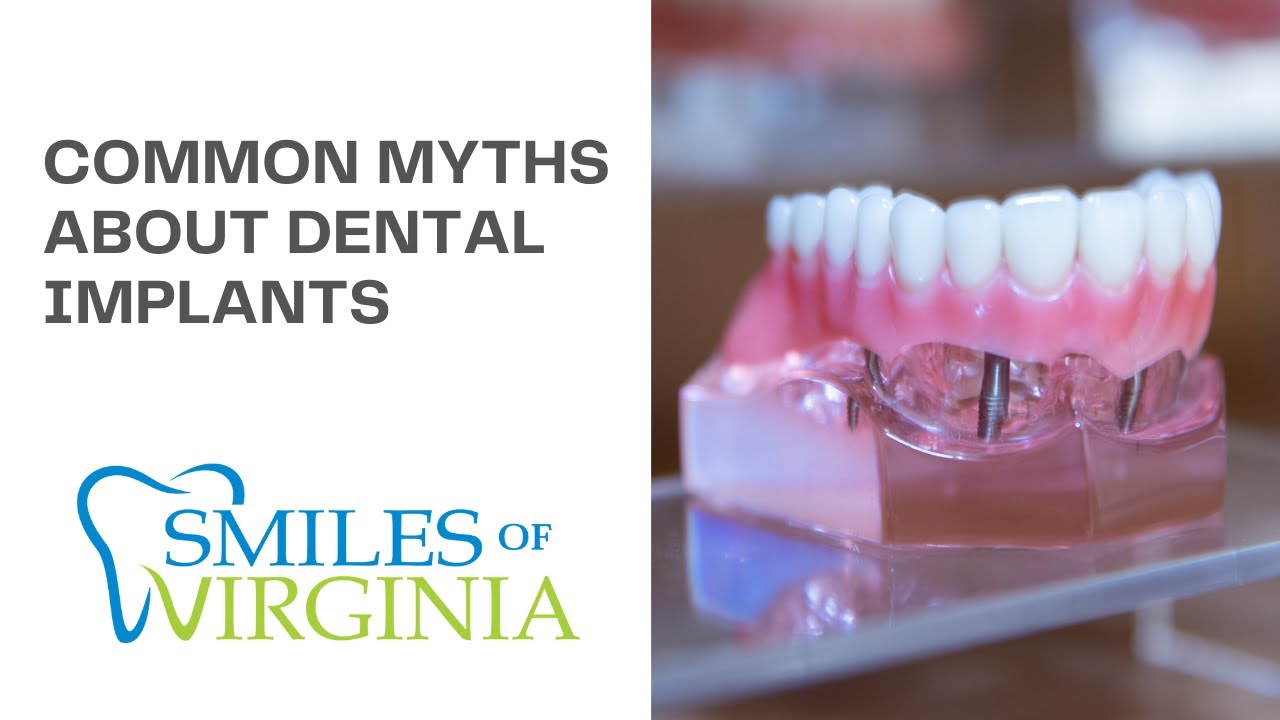 Dr. Oestervemb explains common dental implant myths — video