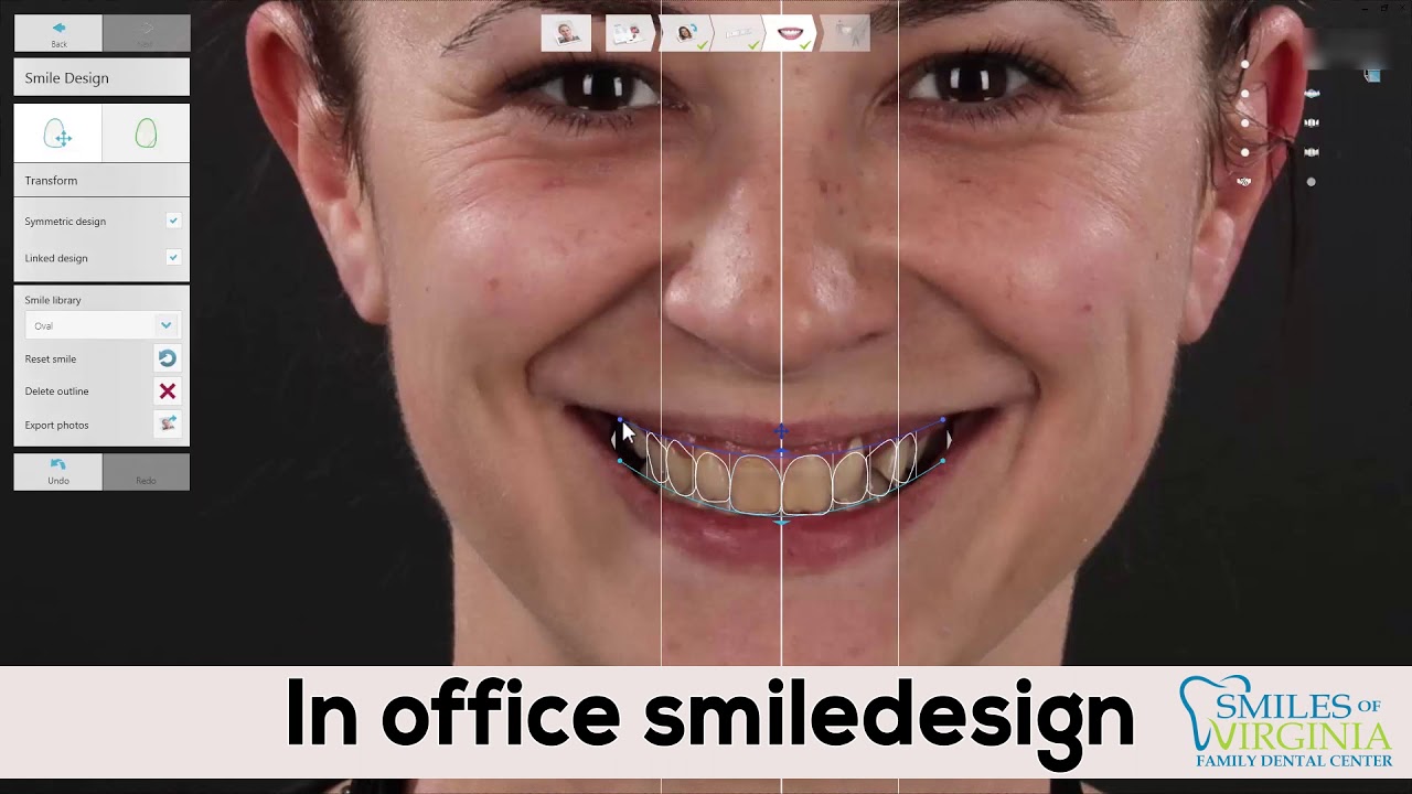 Inside the on-site dental lab — smile design in progress (video)