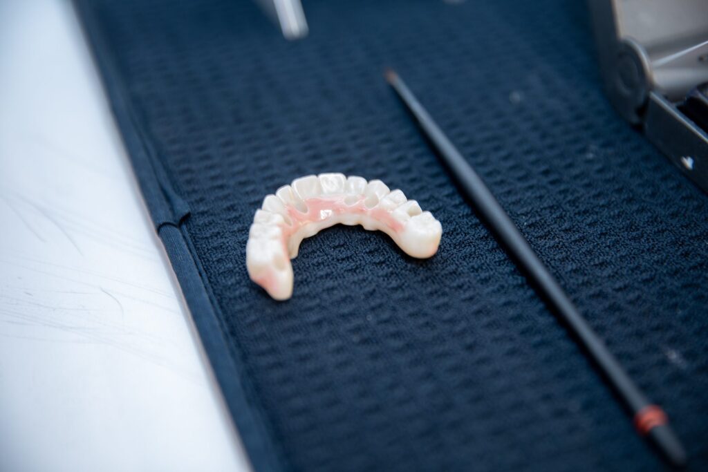Full-arch fixed All-on-4 implant bridge on a lab bench at Winchester Dental Implant & Sedation Center