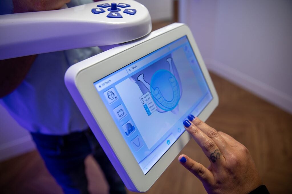 Touchscreen of the cone beam CT scanner showing a 3D dental scan used to plan guided implant surgery