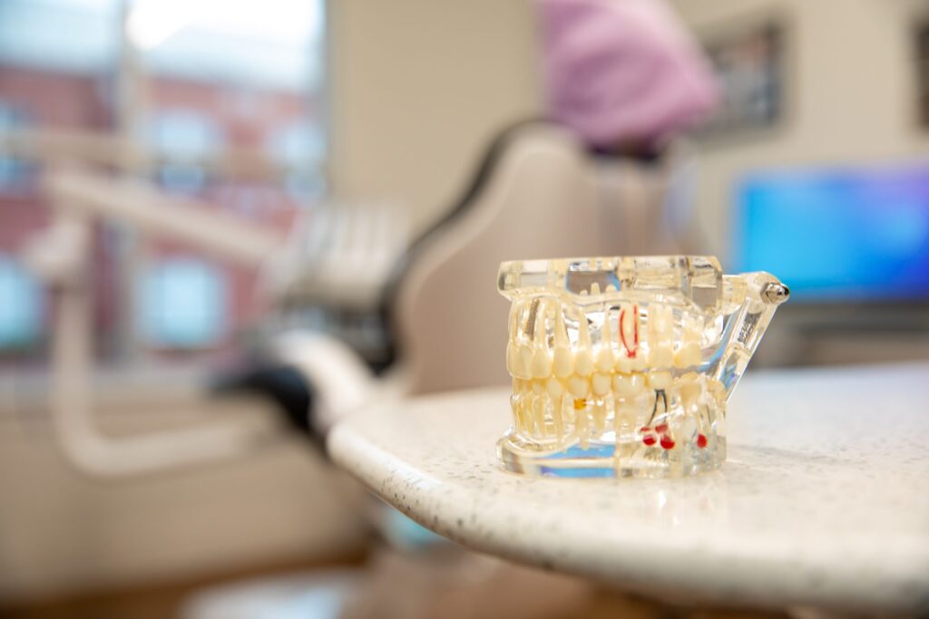 Clear educational dental model showing a dental implant beside natural tooth roots