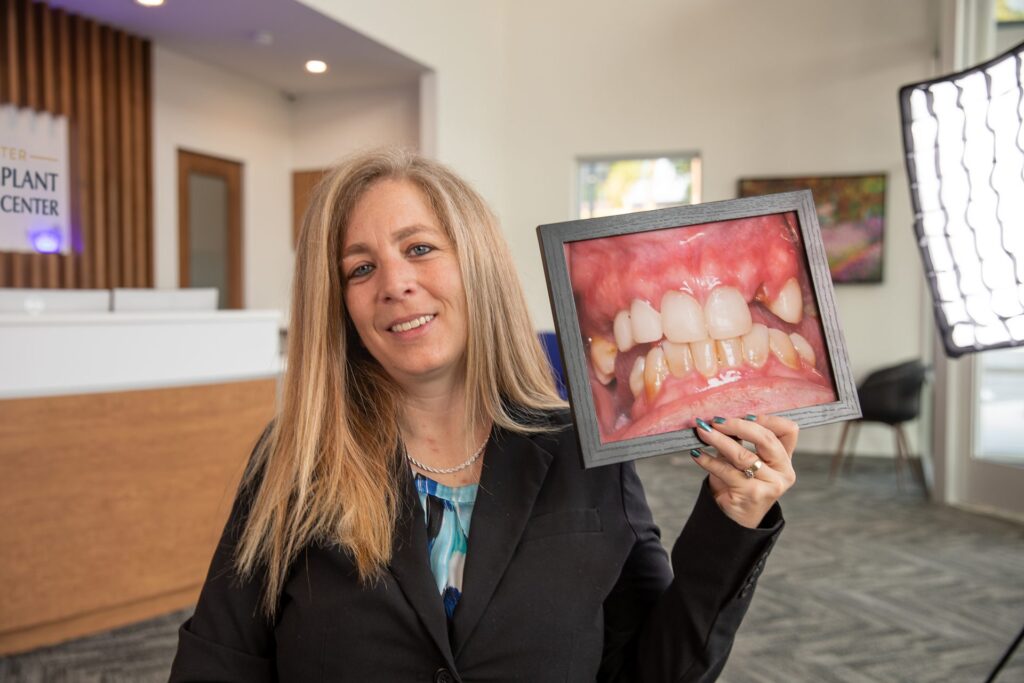 Full-mouth rehabilitation patient holding a framed before photo of her teeth prior to crowns