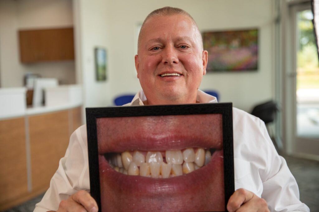 Smiling upper All-on-4 dental implant patient holding a framed before photo of his previous teeth